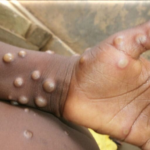 Home » Health » Stakeholders call for reforms in nursing education, healthcare access Health October 29, 2024  Stakeholders call for reforms in nursing education, healthcare access