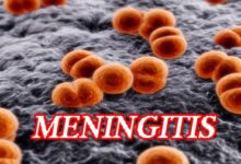 Sokoto warns against spread of meningitis as state records outbreak